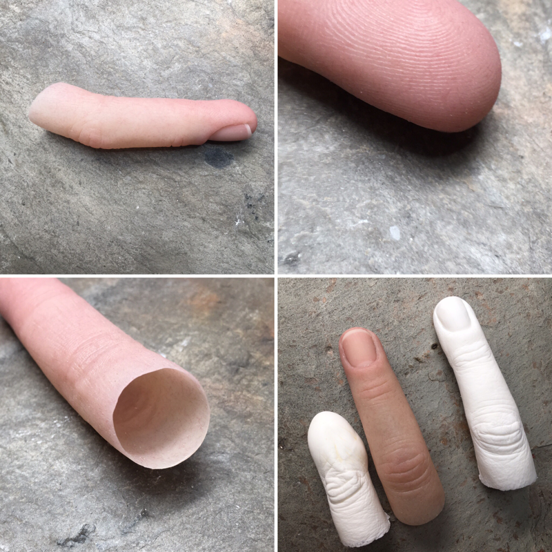 Custom Finger Prosthetics